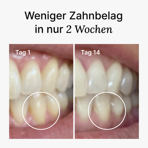 D2 Pro Elektrische Zahnbürste